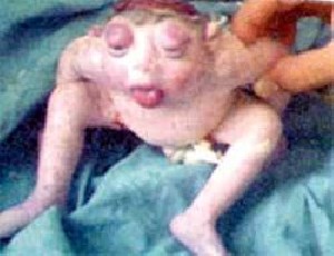 تولد کودکی عجیب به شکل قورباغه در مصر